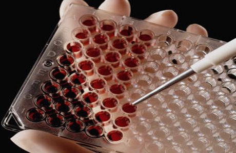 Heteroseksuele overdracht van HIV: nieuwe ontdekkingen