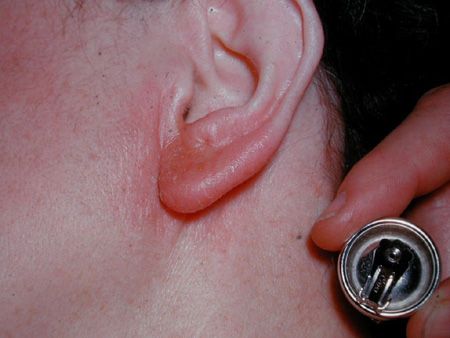 Neem contact op met Allergy
