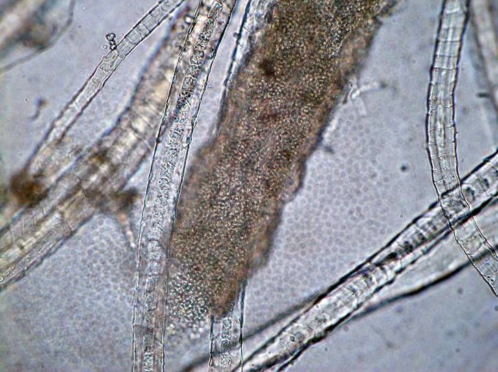 Ziekteverwekkers van epidermophytosis